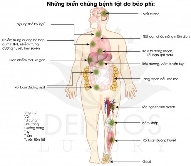 Thực phẩm chức năng Viên uống hỗ trợ giảm cân OZ Slim USA (40 viên) - Nhập khẩu Mỹ 4