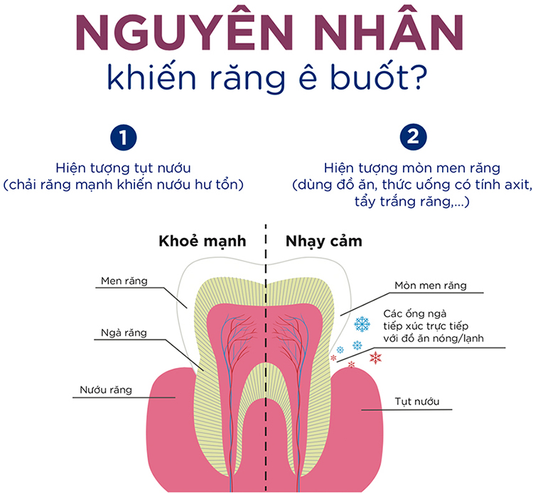 Combo 3 Kem Đánh Răng P/S Sensitive Expert Giảm Ê Buốt Chuyên Sâu (100g/tuýp)