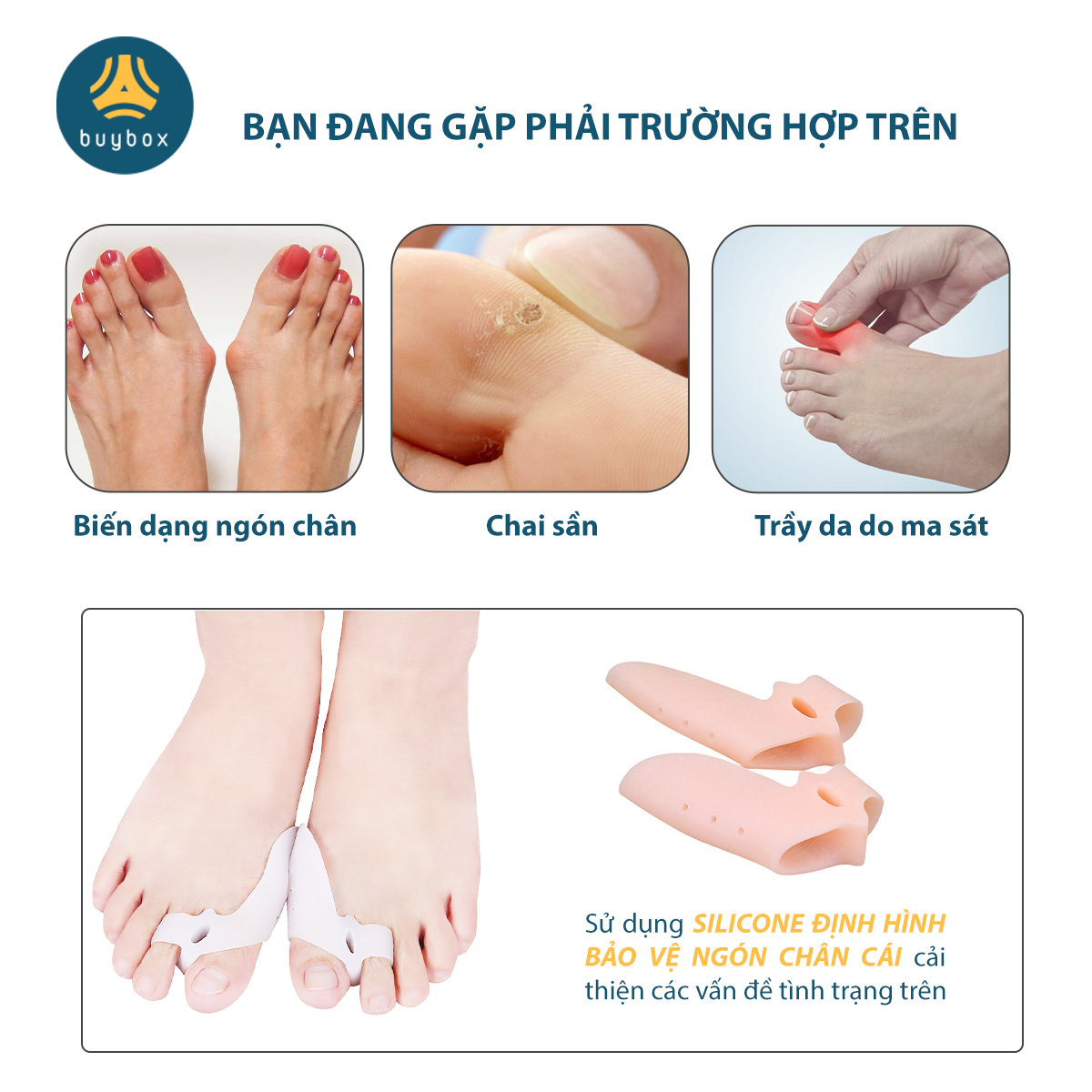 Combo 3 Cặp Nẹp Chỉnh Hình Ngón Chân Cái, Tách Ngón Giảm Đau Chân Khi Di Chuyển Nhiều - Buybox - BBPK271