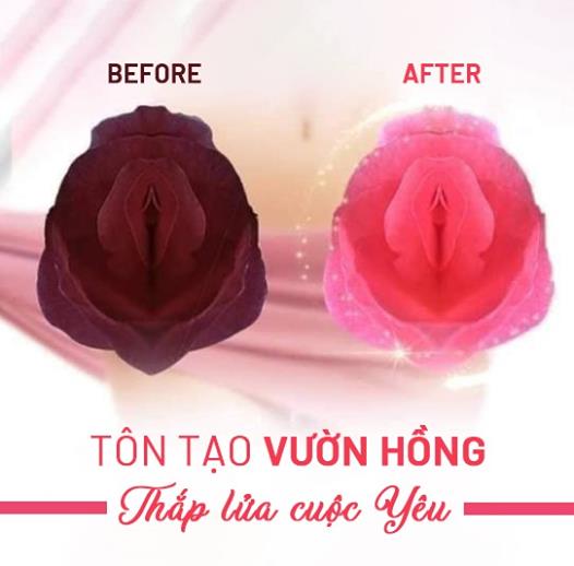 Giải pháp trẻ hóa vùng kín hiệu quả