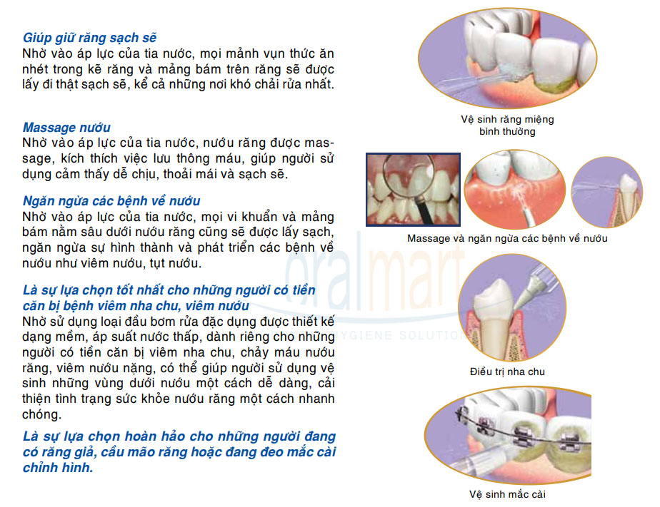 Máy tăm nước cá nhân không dây Waterjet Flosser Cordless Advanced