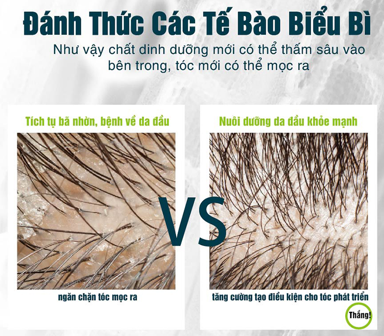 Dầu Gội Thảo Dược ESSEHAIR