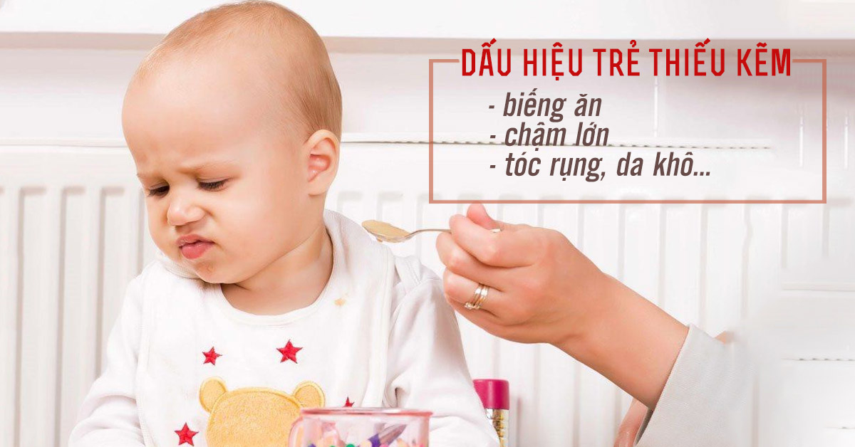 trẻ thiếu kẽm